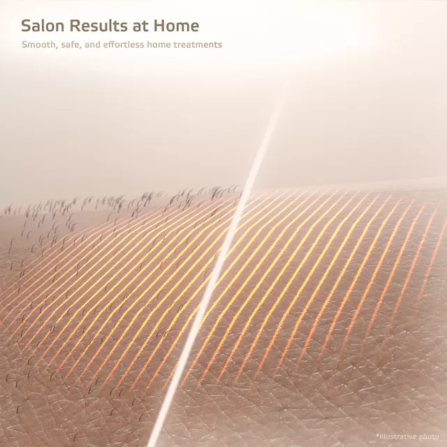 IPL-Epiliergerät inSPORTline Aphira