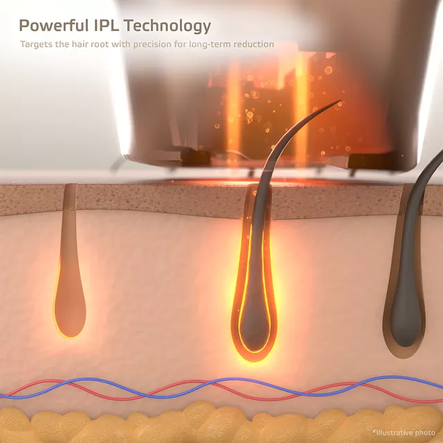 IPL-Epilierer inSPORTline Eriva
